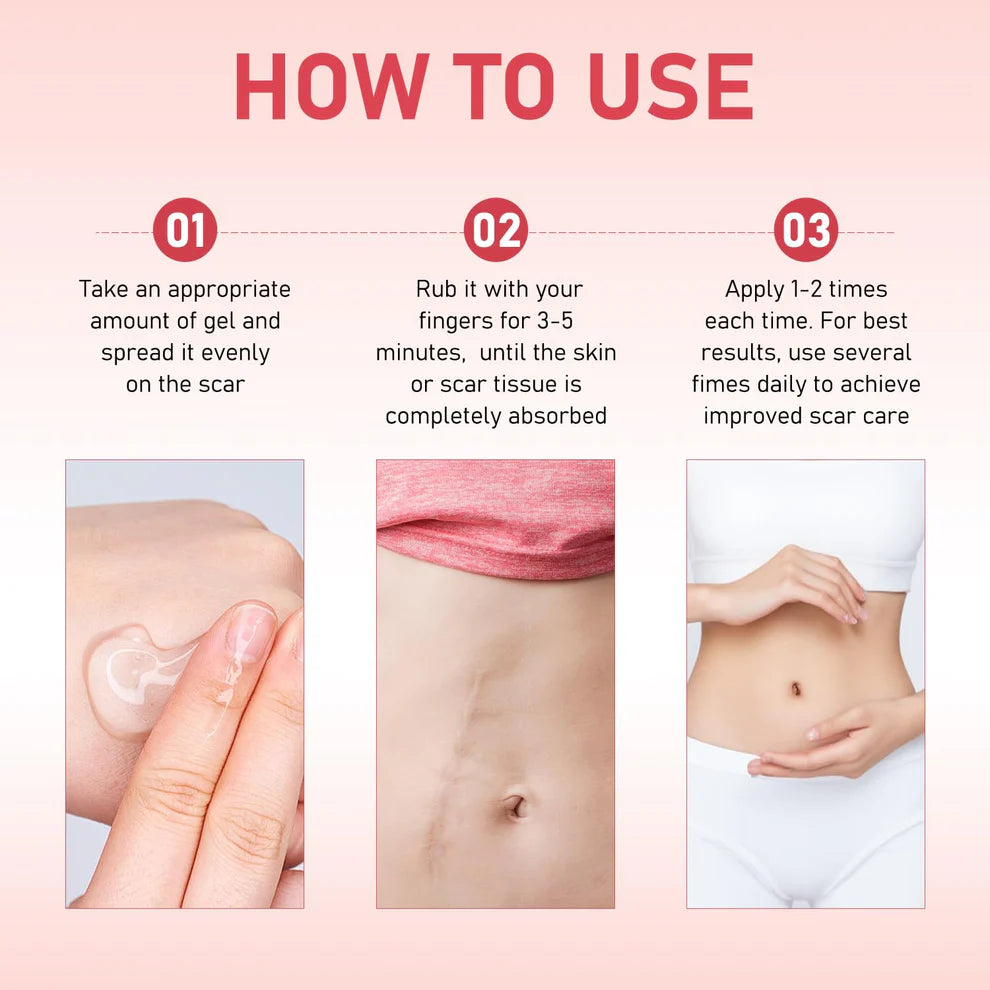 Scar Soothing Cream & Smoothing Cream for Scars