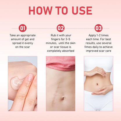 Scar Soothing Cream & Smoothing Cream for Scars