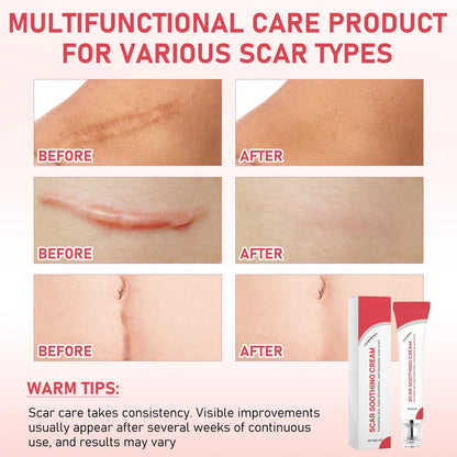 Scar Soothing Cream & Smoothing Cream for Scars